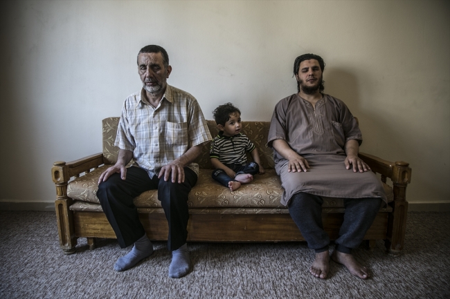 Bombardıman sonrası görme kaybı yaşayan Suriyeliler yardım bekliyor