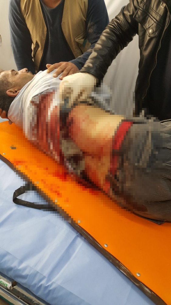 PYD/PKK, Azez'de sivillere saldırdı: Çok sayıda yaralı var