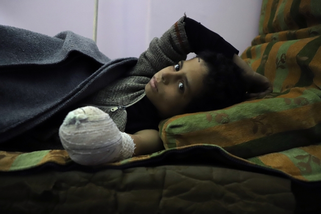 Esed rejimi katliama devam ediyor: Son 12 günde 674 sivil öldü