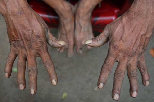 Bangladeşli adam ağaçları kurtarmak için sokak sokak geziyor