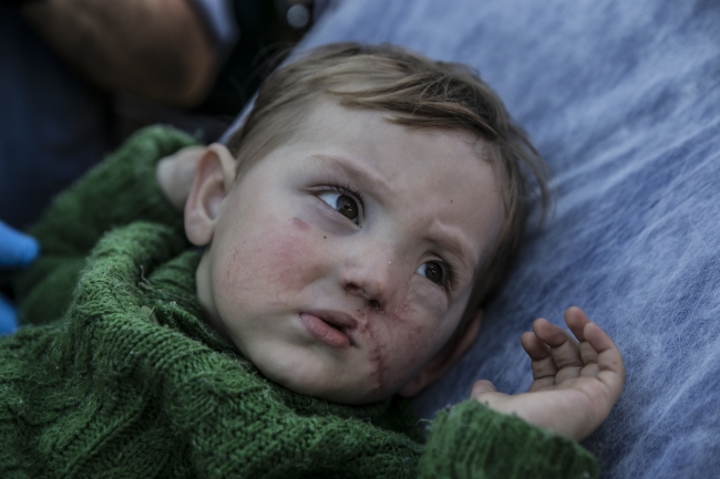 Doğu Guta'da yaralanan Kasım bebek Türkiye'ye getirildi