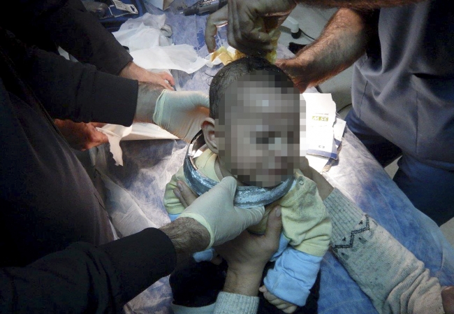 Oyun oynadığı darbukaya kafası sıkıştı