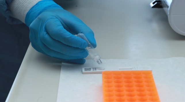 Koronavirüs ile ilgili merak edilenleri siz sordunuz uzmanlar yanıtladı