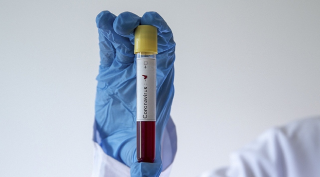 Koronavirüs ile ilgili merak edilenleri siz sordunuz uzmanlar yanıtladı