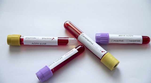 Koronavirüs ile ilgili merak edilenleri siz sordunuz uzmanlar yanıtladı