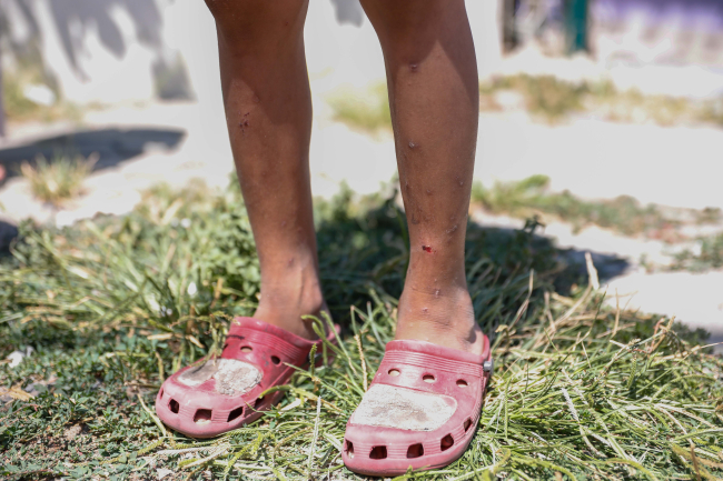 İstanbul'da 'Aedes' türü sivrisineklerde artış var