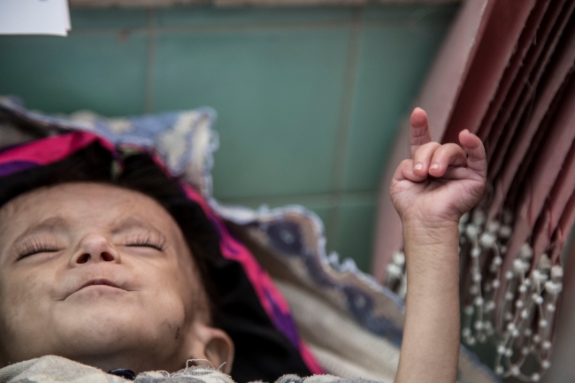 Yemen'de halkın gıda stoklarına erişimine izin verildi