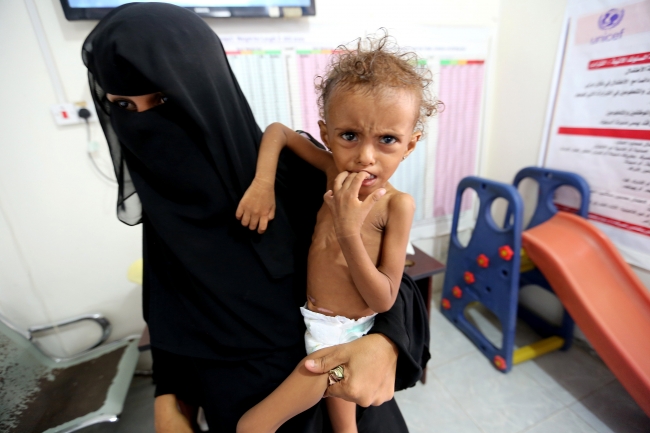 Yemen'de  8,6 milyon çocuk sudan da mahrum