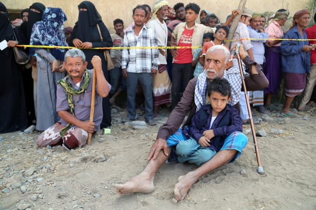 Yemen'de kıtlık en çok çocukları vuruyor