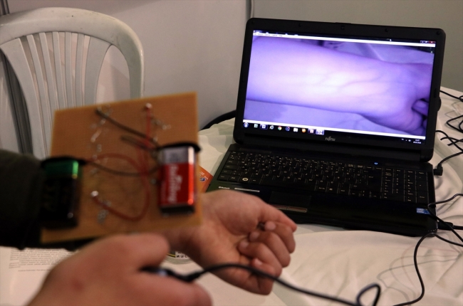 Kanser hastası arkadaşları için proje geliştirdiler