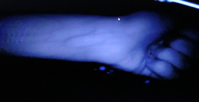 Kanser hastası arkadaşları için proje geliştirdiler