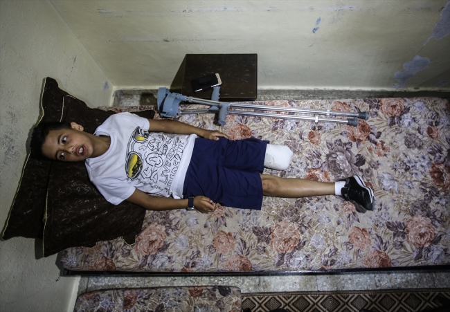 11 yaşındaki Gazzeli Nevfel: Bacağımı kaybedecek hangi suçu işledim?