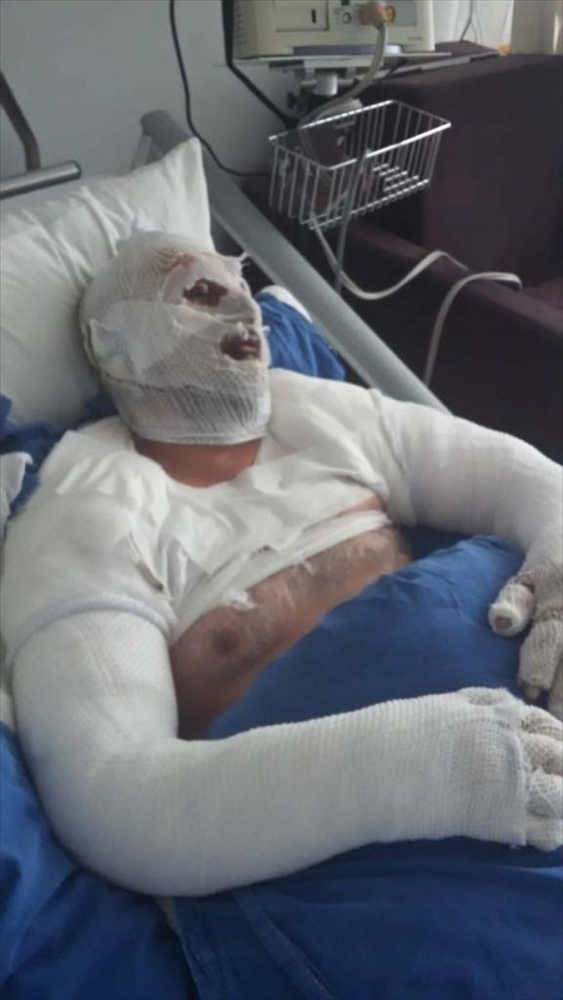 Banyoda biriken gaz, saç kurutma makinesi çalışınca patlamaya yol açtı