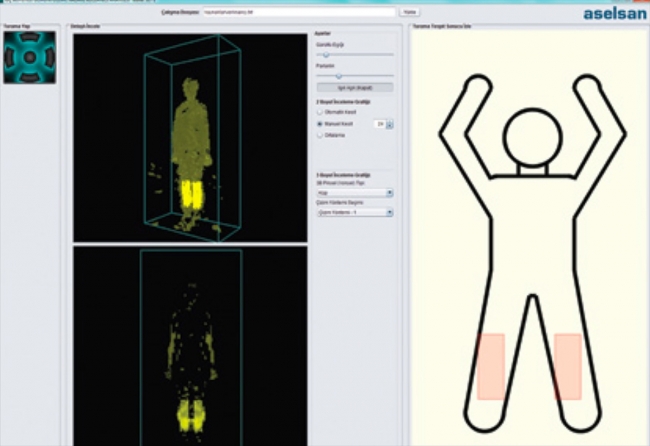 ASELSAN 'vücut tarayıcı' geliştiriyor