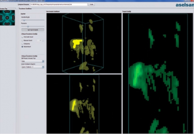 ASELSAN 'vücut tarayıcı' geliştiriyor