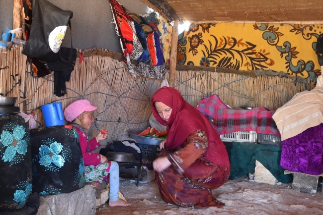 Yanık izleri nedeniyle dışlanan Suriyeli çocuk tedavi olmak istiyor