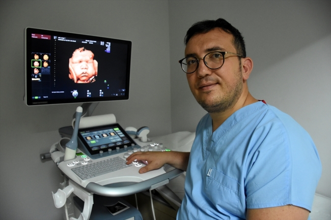 Ultrason fotoğraflarından koleksiyon yaptı