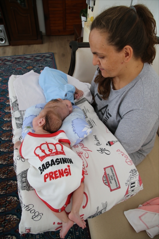 Siyam ikizlerini ayrı ayrı kucaklarına almak istiyorlar