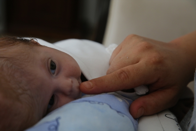 Siyam ikizlerini ayrı ayrı kucaklarına almak istiyorlar