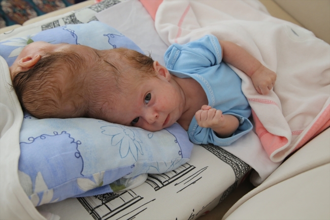 Siyam ikizlerini ayrı ayrı kucaklarına almak istiyorlar