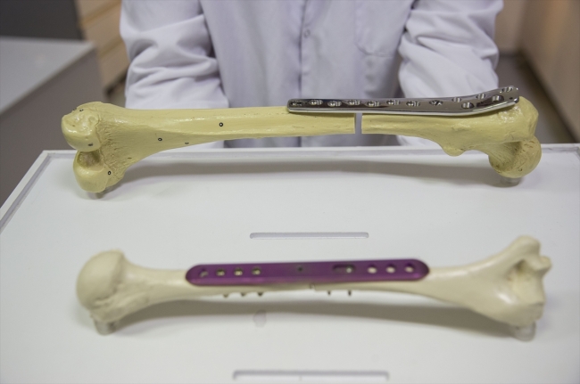 Kemik boyunu uzatan icadıyla adını dünyaya duyurdu