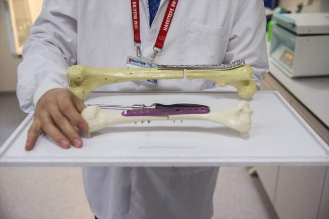 Kemik boyunu uzatan icadıyla adını dünyaya duyurdu