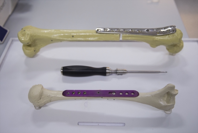 Kemik boyunu uzatan icadıyla adını dünyaya duyurdu