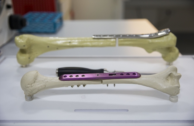 Kemik boyunu uzatan icadıyla adını dünyaya duyurdu