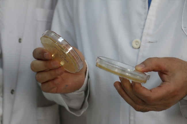 Erzurum'da yerli "nano-keratin" üretildi