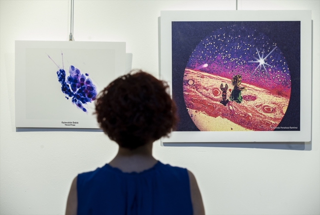 Mikroskopla inceledikleri dokuları fotoğrafladılar