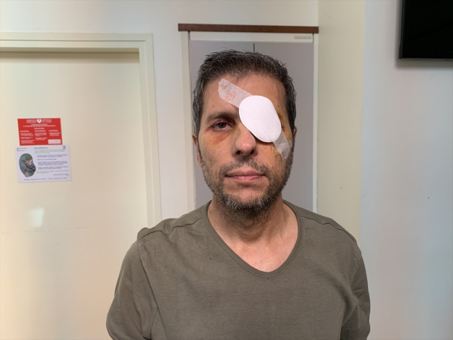 Paris'te gözünden yaralanan AA Foto Muhabiri Yalçın, yaşadıklarını anlattı