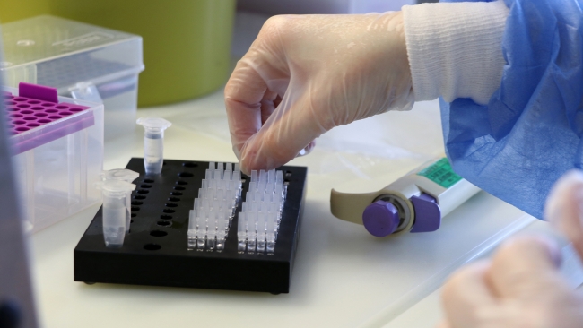 Sinovac aşısının antikor düzeyi araştırması başladı