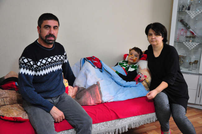 Sokak köpeğinin saldırdığı Mert'in yüzüne 60 dikiş atıldı