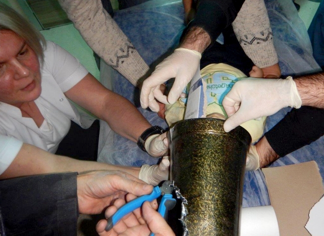 Oyun oynadığı darbukaya kafası sıkıştı