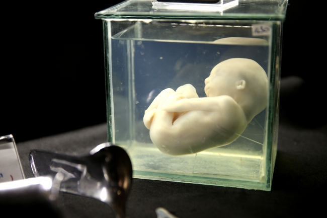 Bursa Sağlık Tarihi Müzesi tıp tarihine ışık tutuyor