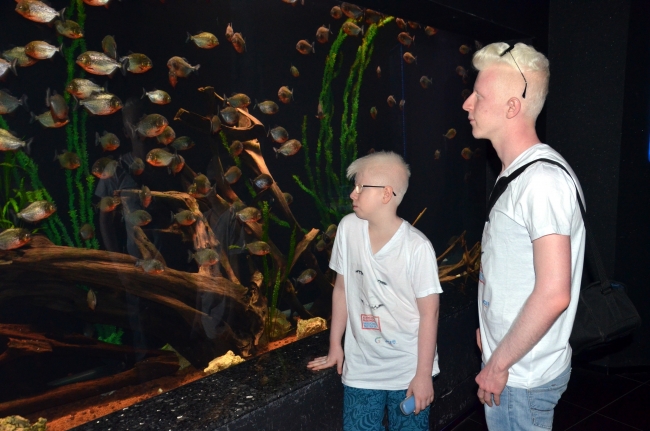 Dünya Albinizm Farkındalık Günü'nde 'beyaz melekler'in sorunları anlatılacak