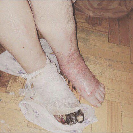 Rusya'da yanlış ayağı kesilen kadın hayatını kaybetti