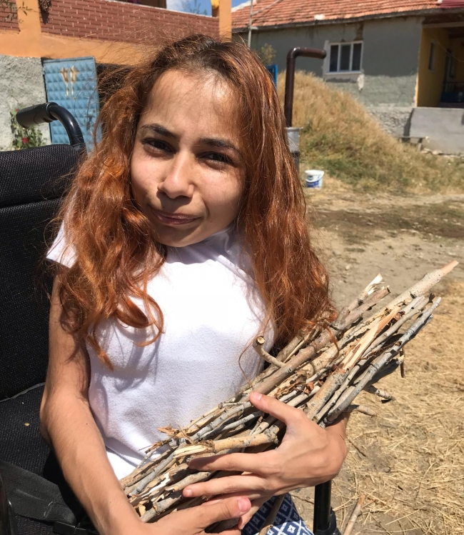 ''Cam Kız''ı iyileştiren yollar