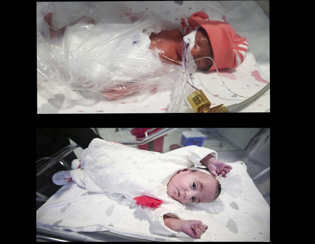 Dünyaya 460 gram gelen bebek 137 gün sonra annesine kavuştu