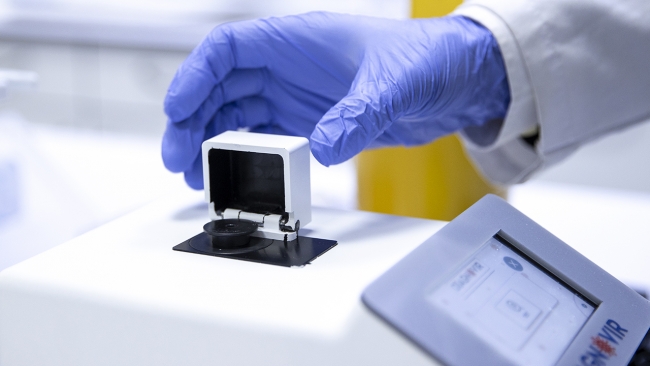 Koronavirüsü 10 saniyede teşhis eden yerli test seri üretimde