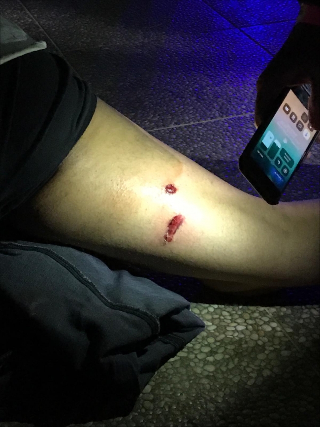 AA’nın Orta Doğu Editörü Turgut Alp Boyraz, İsrail polisinin Mescid-i Aksa’daki müdahalesinde bacağından 2 plastik mermiyle vuruldu. | Fotoğraf: AA