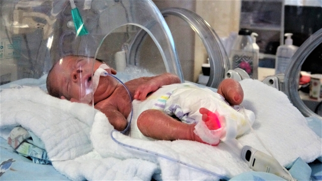 680 gram doğan parmak bebek hayata tutunmayı başardı