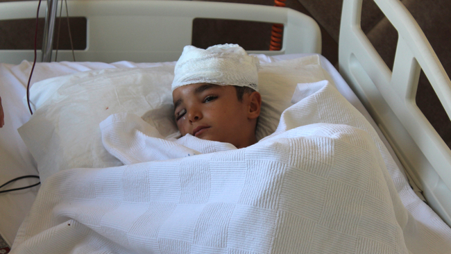 Sokak köpeğinin saldırdığı çocuk ölümden döndü