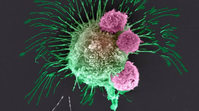 Kodlanmış T hücreleri kanser hücresine yapışıyor.