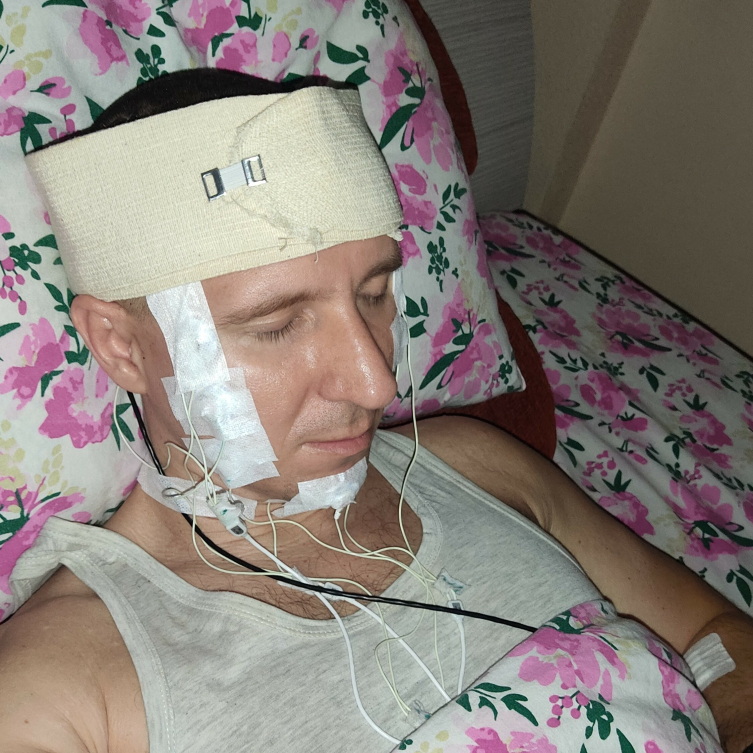 Rüyalarını Kontrol Etmek İçin Matkapla Kafasını Deldi! 2 Rüyalarını kontrol etmek için matkapla kafasını deldi