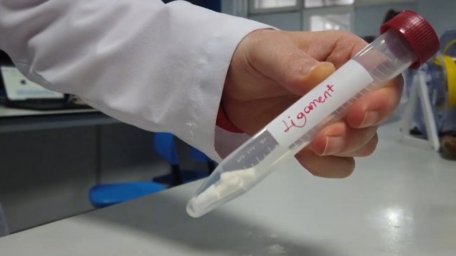 Üniversite öğrencisi yapay ligament üretti