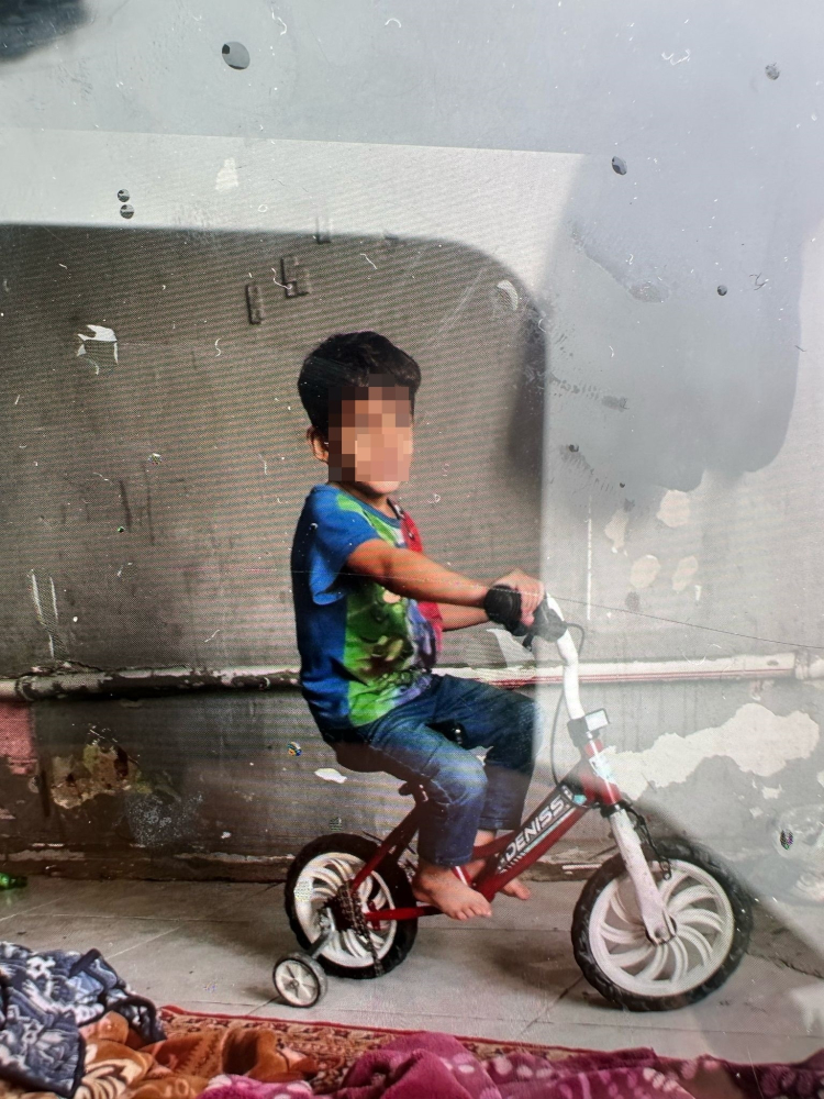 Yalova'da başıboş köpeklerin saldırdığı çocuk ağır yaralandı