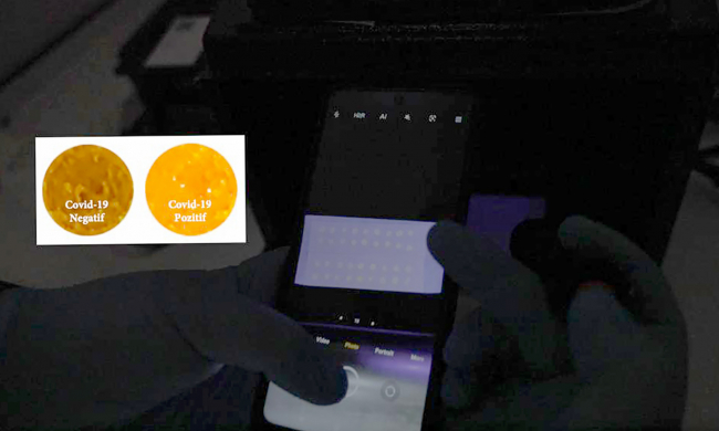 COVID-19'u 1 saniyede tespit eden yerli kit geliştirildi