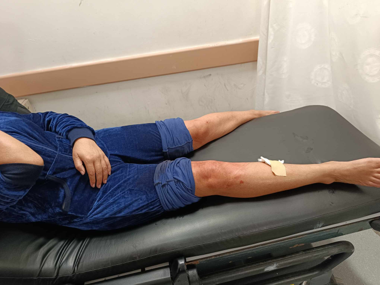 Sahilde yürüyen kadına sahipsiz köpekler saldırdı