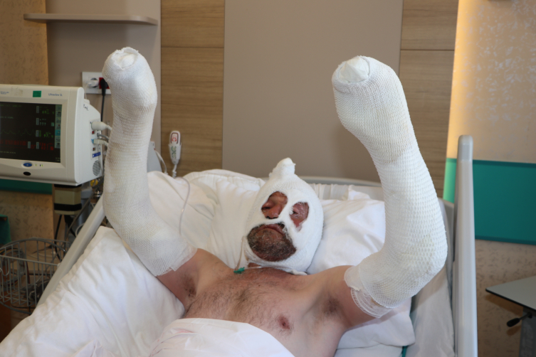 Sobanın yanında unuttuğu benzin bidonu canından ediyordu